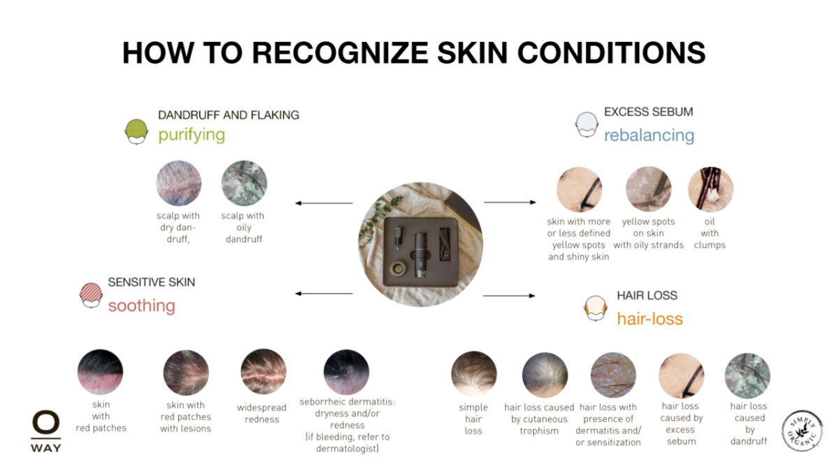 Understanding and Treating Scalp Conditions